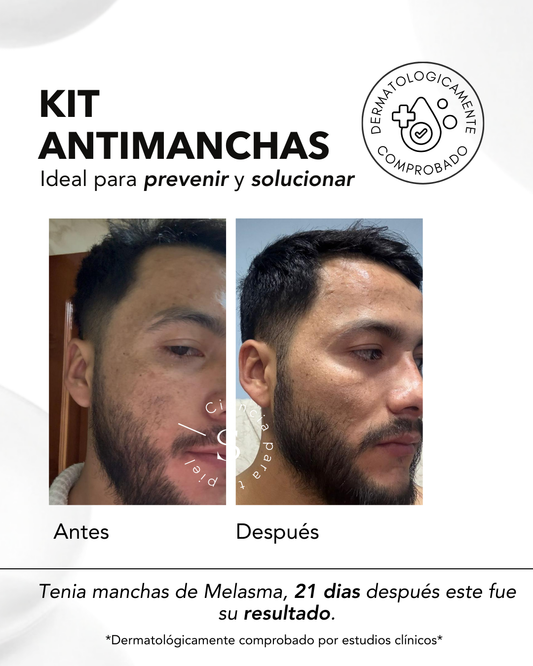 KIT ANTIMANCHAS
