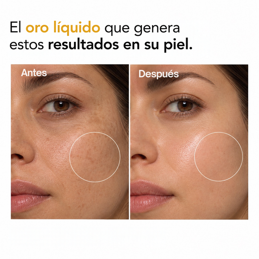 VITAMINA C PURA 30 ML: Efecto Antiedad y luminosidad instantánea