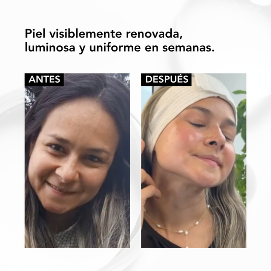 Nano Retinol Encapsulado