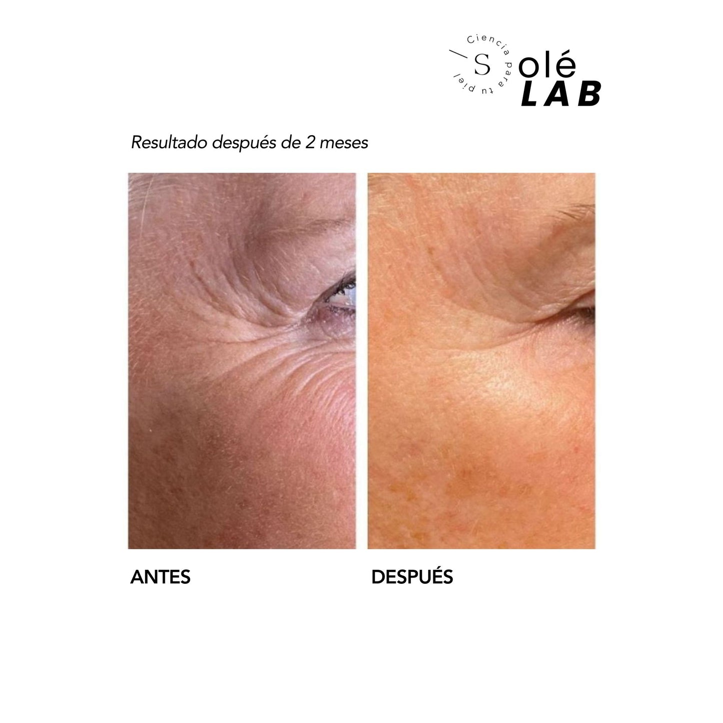 Nano Retinol Encapsulado