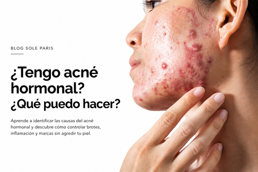 Tengo acne hormonal que puedo hacer