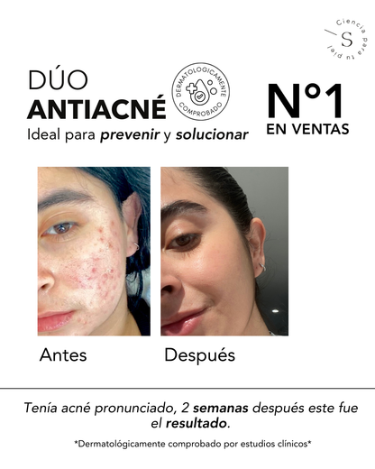 DÚO ACNÉ CONTROL