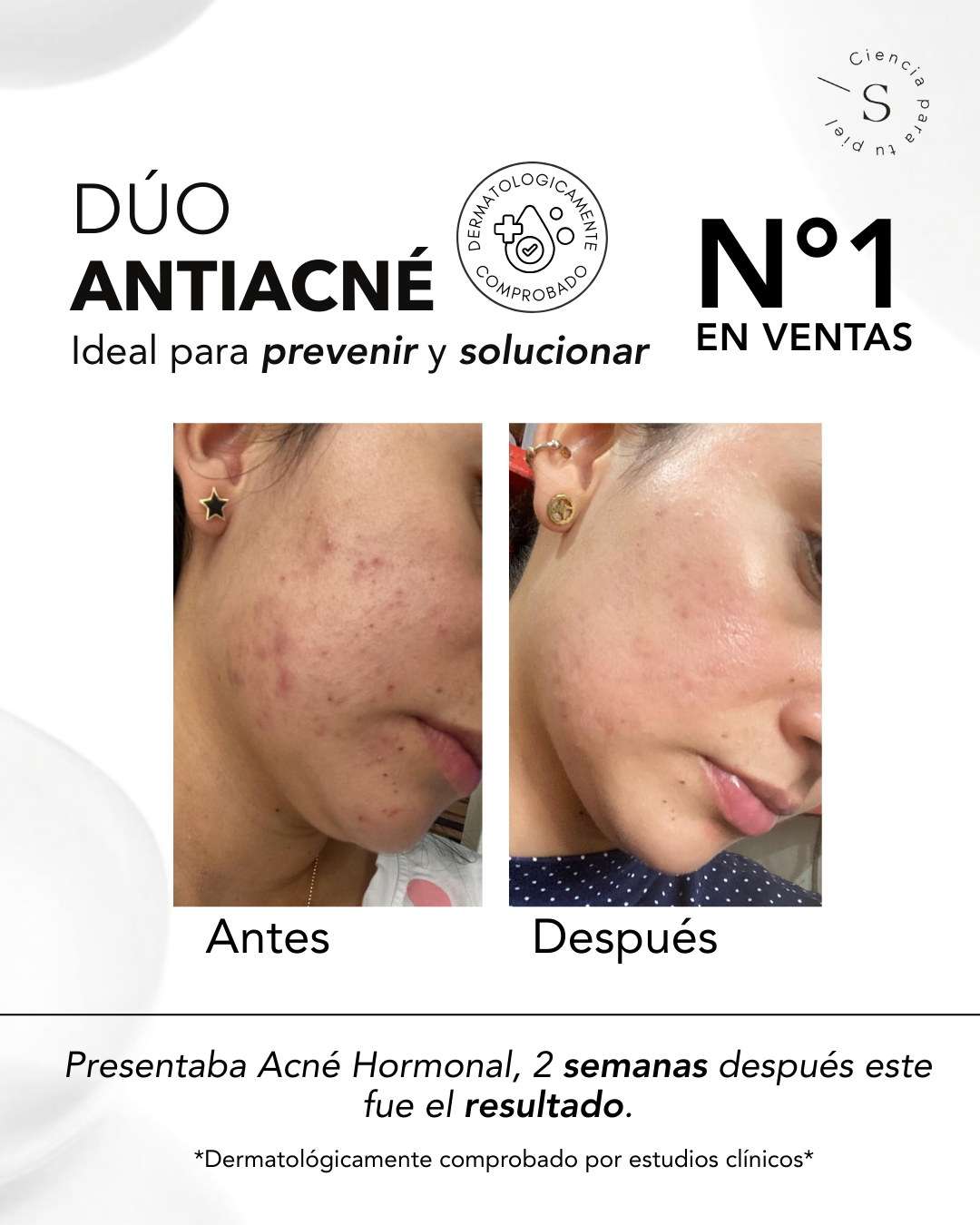 DÚO ACNÉ CONTROL