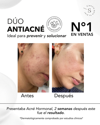 DÚO ACNÉ CONTROL