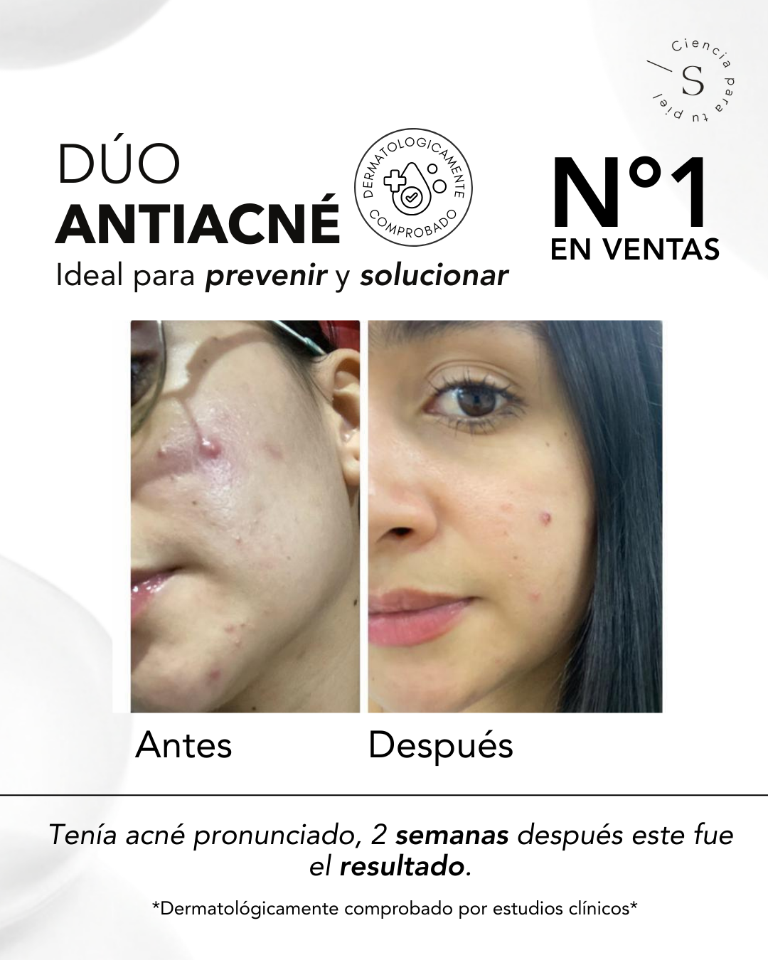 DÚO ACNÉ CONTROL