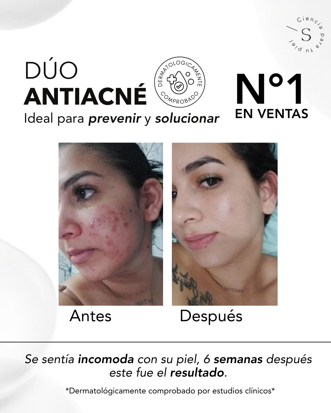 DÚO ACNÉ CONTROL