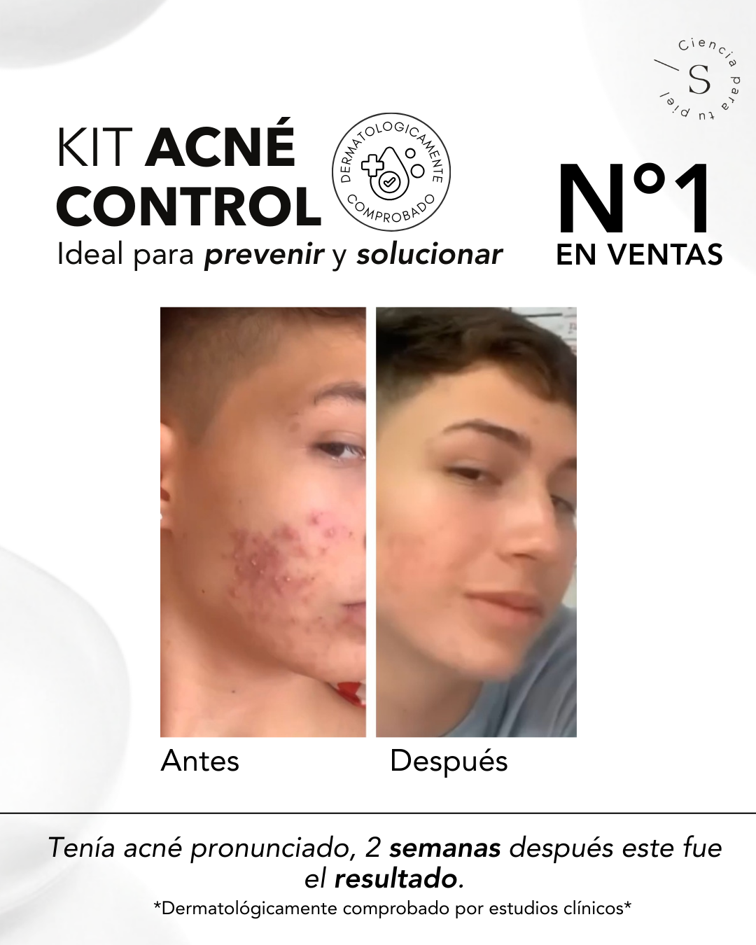 KIT ACNE CONTROL AHA & BHA