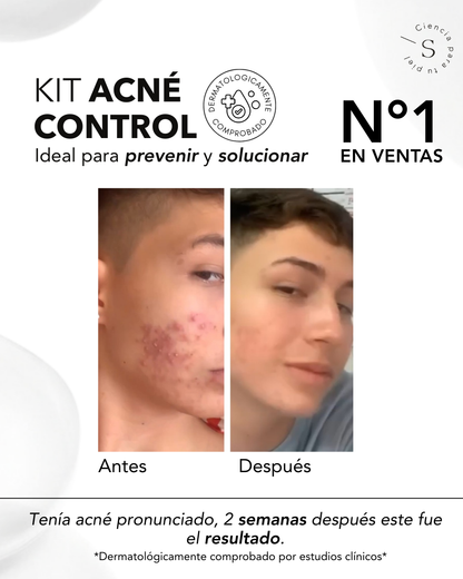 KIT ACNE CONTROL AHA & BHA
