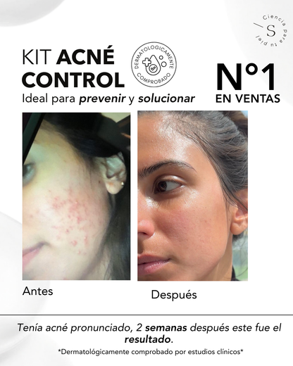 KIT ACNE CONTROL AHA & BHA