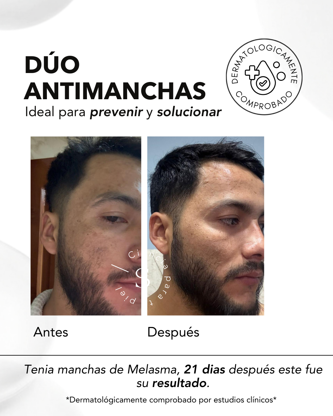 DÚO MANCHAS