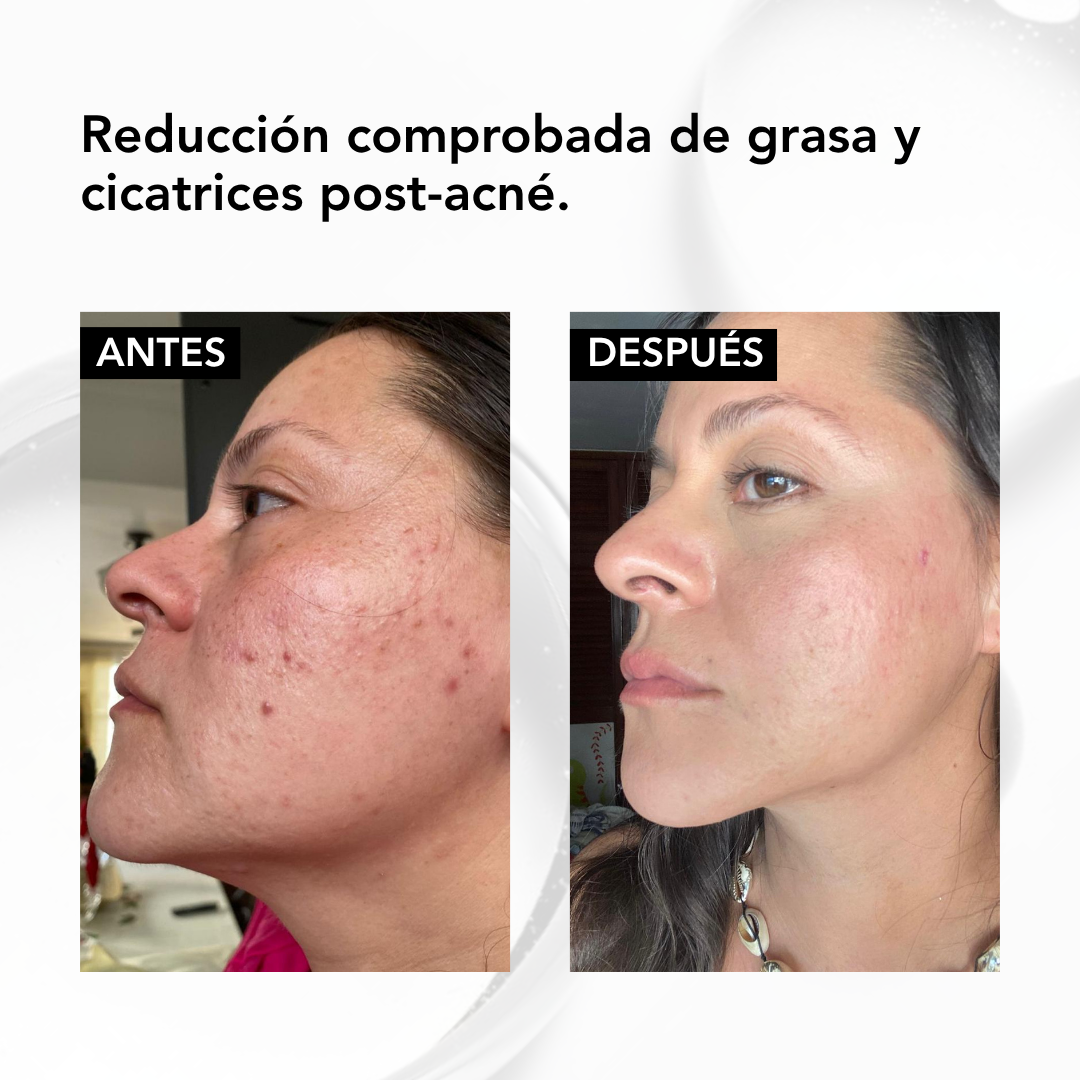 ✨ NIACINAMIDA B3 SERUM FACIAL 30 ML