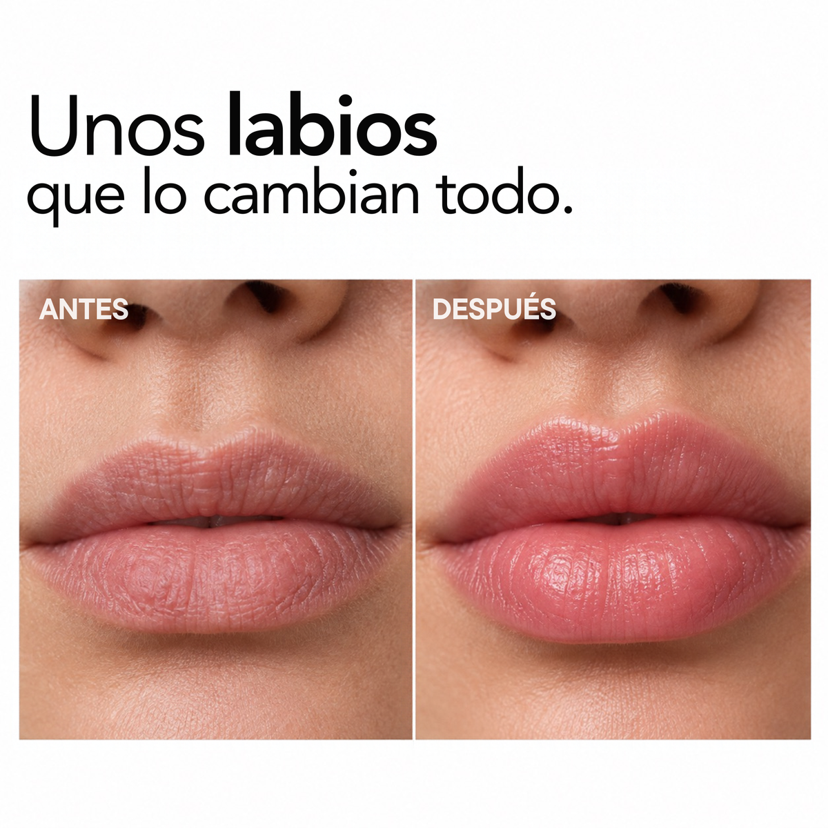 MAGIC LIP VOLUMINIZADOR DE LABIOS