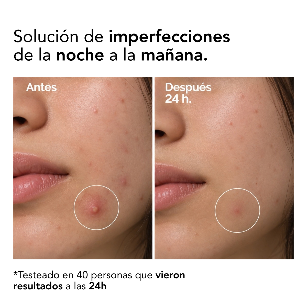 POCIÓN SECANTE TONIC LOTION SKIN SEBUM