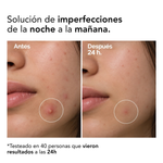 POCIÓN SECANTE TONIC LOTION SKIN SEBUM