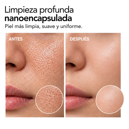 FACIAL BUBBLES BHA + AHA