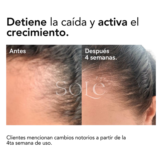 NANOPÉPTIDOS CAPILARES: Crecimiento y anticaida