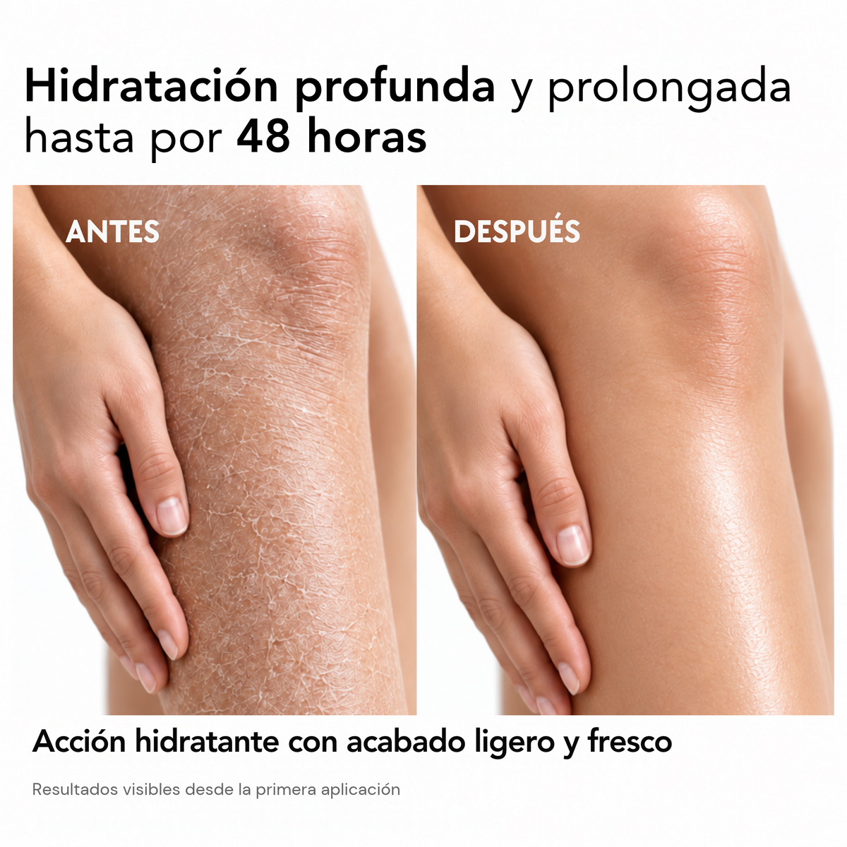 DOSIST CREAM - FORMULA HIDRATANTE Y HUMECTANTE