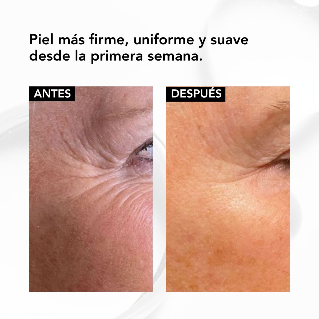 Nano Retinol Encapsulado