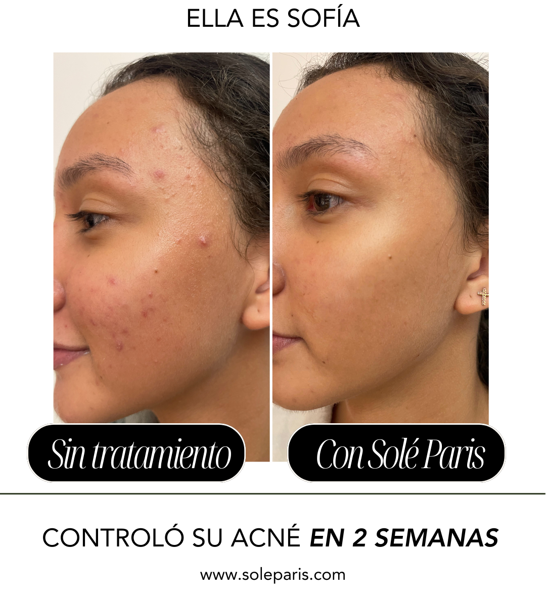 Antes.png