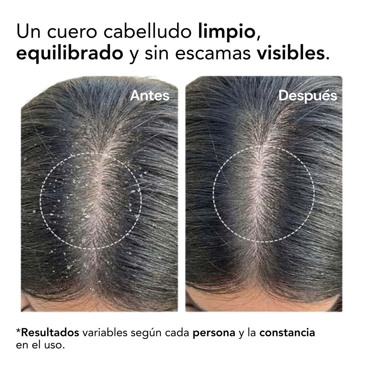 SCALP SCRUB exfoliante antiseborreico capilar