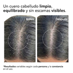 SCALP SCRUB exfoliante antiseborreico capilar