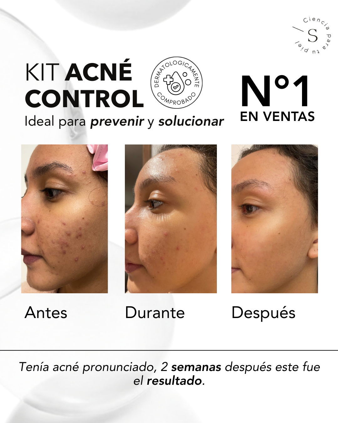KIT ACNÉ CONTROL