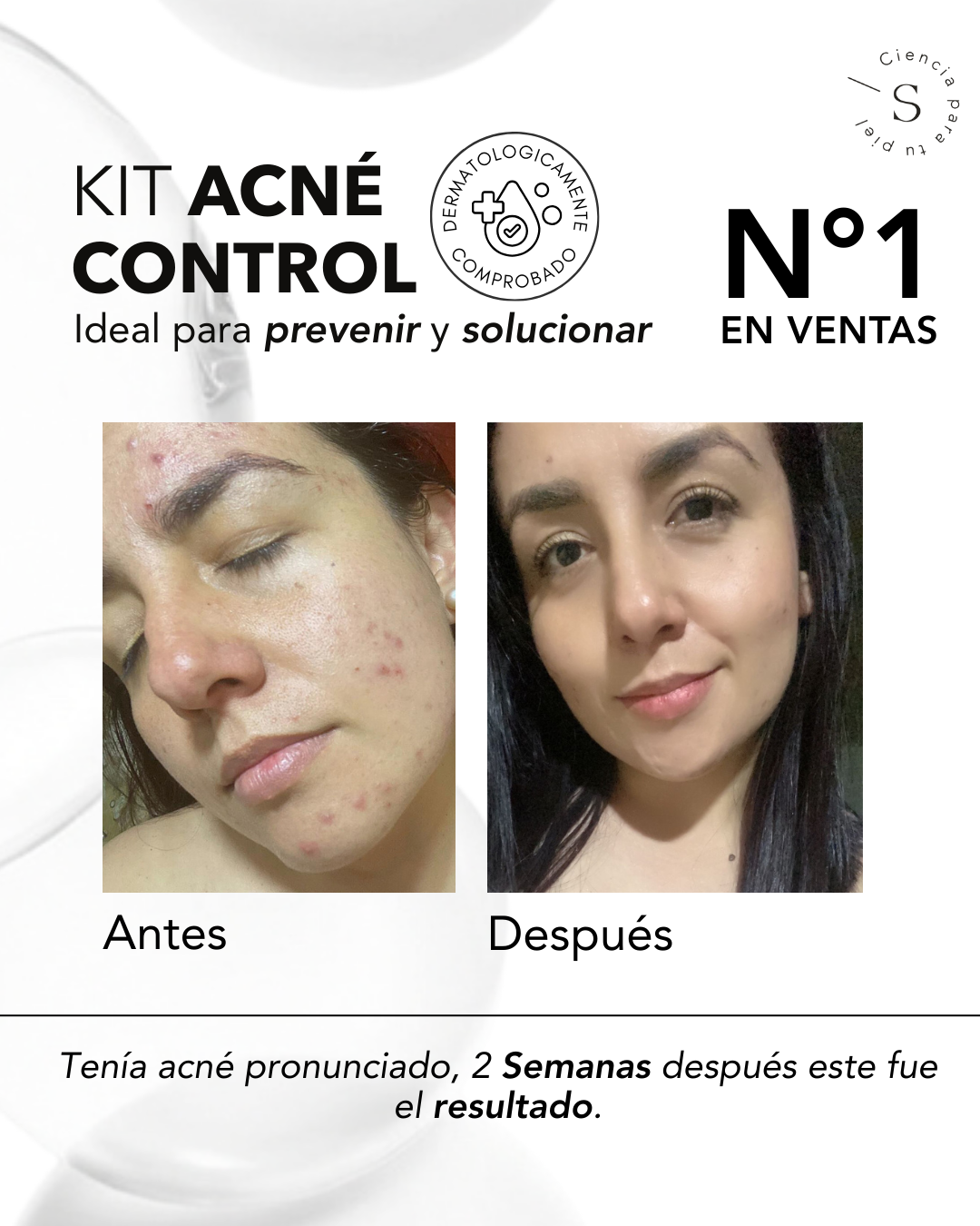 KIT ACNÉ CONTROL