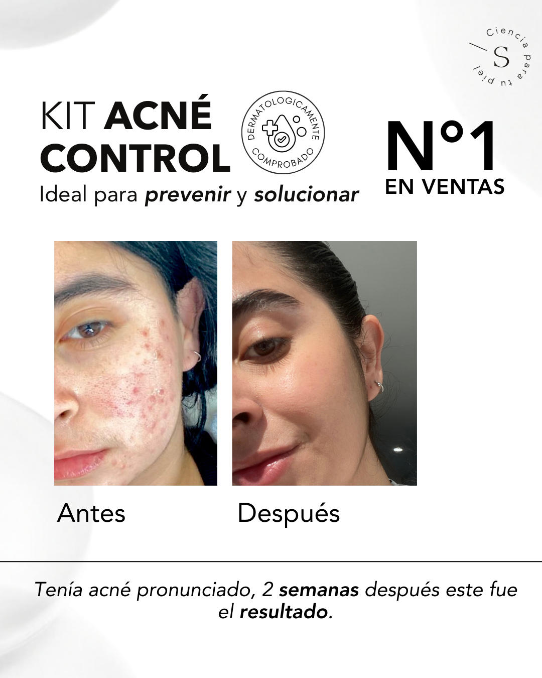 KIT ACNÉ CONTROL
