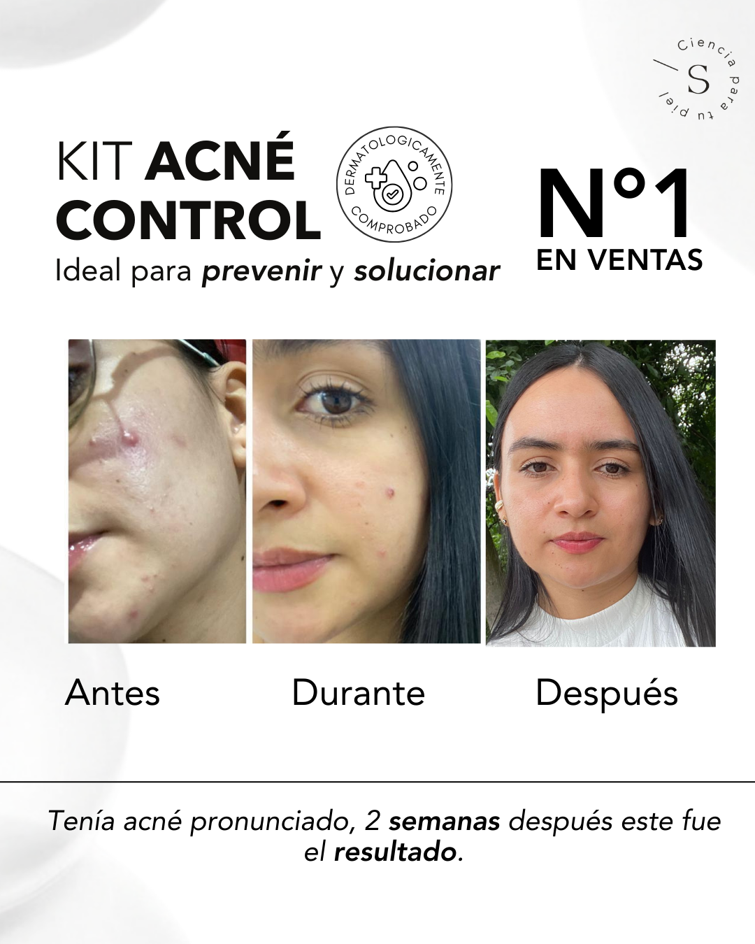 KIT ACNÉ CONTROL