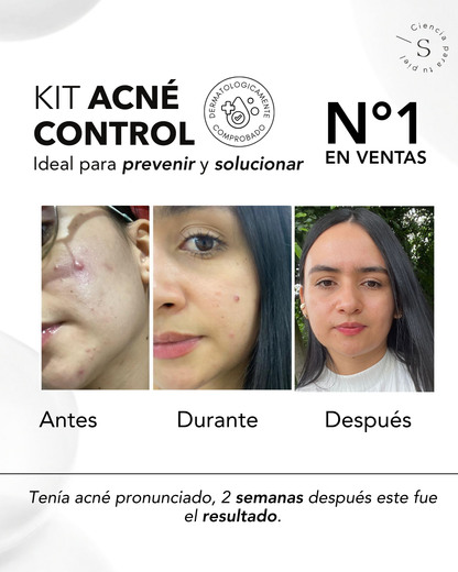 KIT ACNÉ CONTROL