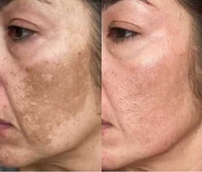 DUO ANTIMANCHAS - PIELES MADURAS