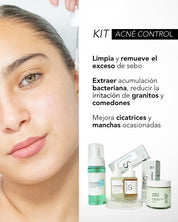 KIT ACNE CONTROL